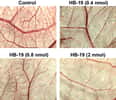 HB-19 inhibe la formation de vaisseaux sanguins. En haut à gauche, le contrôle, ensuite les résultats avec des quantités croissantes (en nanomoles). © PlosOne/Les auteurs de l'étude