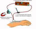 Principe de la méthode de filtration du sang avec des nanoaimants. On commence par faire circuler le sang d'un patient à l'extérieur de son corps pour le réinjecter ensuite à la façon d'une dialyse classique. On injecte les nanoaimants (ovoïdes bleus) qui vont fixer des toxines (noires). Les nanoaimants sont ensuite piégés avec un aimant externe. Crédit : ETH Zurich