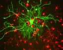 Les neurones transportent les informations via un signal bioélectrique appelé influx nerveux. Le cerveau d'un humain posséderait approximativement 100 milliards de neurones, soit environ 14 fois plus que le nombre d'êtres humains sur Terre. L’implantation de neurones issus de cellules de peau dans le cerveau est l’une des pistes de traitement des maladies dégénératives. © Gerry Shaw, Wikimedia Commons, cc by sa 3.0