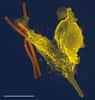 Le nombre de neutrophiles (ici en jaune), cellules immunitaires chargées de la phagocytose, diminue avec le temps, aussi bien chez l'homme que chez la femme. © Volker Brinkmann, Plos Pathogens, cc by 2.5