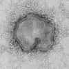 Le virus de la grippe A(H7N9) est tout nouveau chez l'Homme : avant mars dernier, on ne l'avait jamais vu dans un être humain. Cette forme est très différente des virus H7N9 retrouvés chez les oiseaux. Il s'avère mortel dans environ 20 % des cas, mais ceci serait pour le moment une surestimation. © Cynthia Goldsmith, CDC, DP