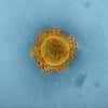 Le coronavirus doit son nom à sa couronne de spicules sur son enveloppe, visible en microscopie électronique. © NIAID, Flickr, CC by 2.0