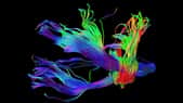 La substance blanche du cerveau étudiée in vivo grâce à la tractographie. La tractographie offre la possibilité d’étudier in vivo la substance blanche du cerveau, celle constituée d’axones myélinisés qui relient les régions de matière grise. Cette gaine de myéline, qui entoure les terminaisons nerveuses, permet à l’information d’être propagée plus rapidement. Sur cette image, les faisceaux pyramidaux apparaissent en bleu et les fibres transverses pontocérebelleuses sont colorées en rouge et vert. © CNRS Photothèque, CI-NAPS, GIP Cyceron