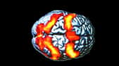 L'IRM permet de&nbsp;voir les régions qui s'activent dans le cerveau. Ce cliché d’IRM fonctionnelle n’a rien à voir avec un test de Rorschach (ces planches utilisées en psychiatrie pour évaluer la santé psychiatrique d’un individu). Les taches orange correspondent aux régions du cerveau activées par un sujet lors d’un exercice durant lequel il devait suivre des yeux une cible mobile.
© CNRS Photothèque, Ci-Naps, Laurent Petit, Bernard Mazoyer
