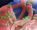 Le VIH utilise une intégrase pour insérer son matériel génétique dans celui de la cellule qu’il infecte. © Goldsmith et al., CDC, DP
