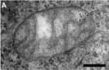 Il faut avoir de bons yeux, mais l'on peut apercevoir sur la droite de la mitochondrie des petits points noirs, qui révèlent en fait la présence de l'ADN de l'organiste cellulaire. La barre noire représente 200 nm. © Iborra et al. 2004, BioMed Central