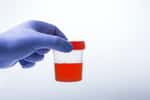 L’hématurie se traduit par la présence de sang dans les urines. © sercansamanci, Adobe Stock