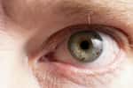 Le syndrome de Gougerot-Sjögren se manifeste par un syndrome sec des yeux et de la bouche. © EduardSkorov, Adobe Stock