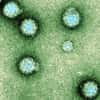 Le virus du Chikungunya possède une forme sphérique. © AJC1, Flickr, CC by-nc 2.0
