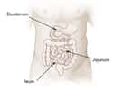Le jéjunum est une des trois parties de l'intestin grêle. © DR