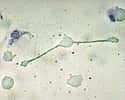 Les macrophages peuvent phagocyter des éléments étrangers. © Obli, Wikimedia, CC by-sa 2.0