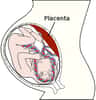 Le placenta est un organe très particulier. Il permet de connecter la mère à son petit chez les mammifères placentaires, et ainsi d'apporter les éléments nécessaires à la croissance du bébé en gestation. Dans le cas d'un placenta praevia, celui-ci est placé trop bas dans l'utérus, et peut rompre en fin de grossesse. © Henry Gray, Gray's Anatomy, Wikipédia, DP
