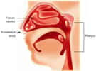 La rhinopharyngite est une atteinte inflammatoire du pharynx, associée à une atteinte des fosses nasales. Crédits : GSK.