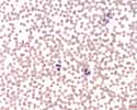 Les polynucléaires sont des globules blancs dont le noyau forme plusieurs lobes. © Prof. Erhabor Osaro, Wikimedia Commons, CC by-sa 4.0