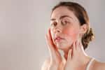 Des mesures hygienodiététiques simples, comme se laver le visage matin et soir, permettent de limiter la rosacée. © _KUBE_, Adobe Stock