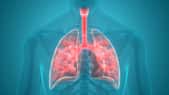 Micrographie d'un échantillon de tissu pulmonaire montrant la présence de Pneumocystis jirovecii, l'agent responsable de la pneumocystose, mettant en évidence les défis posés par cette infection pulmonaire opportuniste chez les individus immunodéprimés. © magicmine, Adobe Stock