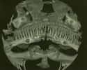 La face du poisson Kryptoglanis shajii présentée ici semble tout droit sortie du film Alien, avec ses quatre rangées de dents pointues. © Lundberg et al., 2014. Proceedings of the Academy of Natural Sciences of Philadelphia