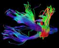 La tractographie, une technique non invasive qui produit ce type de clichés, permet d'étudier in vivo les grands faisceaux anatomiques du cerveau. C'est un exemple des progrès de l'imagerie médicale qui a fait progresser nos connaissances ces dernières années. © CNRS Photothèque/CI-NAPS/GIP CYCERON