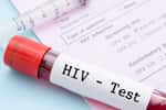 La sérologie VIH se fait en laboratoire d'analyse médicale à partir d'une prise de sang. © gamjai, Adobe Stock