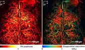 Ce cerveau de souris a été imagé in vivo, sans agent de contraste, par microscopie photoacoustique (PAM). Les chercheurs ont utilisé l'hémoglobine dans les globules rouges du sang pour fournir le contraste (image de gauche). Les niveaux de saturation en oxygène dans l'hémoglobine dans le même cerveau de souris révèlent les artères et les veines corticales (image de droite). © Junjie Yao et Lihong Wang, WUSTL 