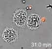 Un macrophage en action : il dévore une conidie