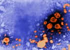 Le virus de l'hépatite B. © US Centers for Disease Control