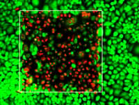 Sur cette image en fausses couleurs prises avec un microscope, les cellules cancéreuses vivantes (en vert) entourent des cellules cancéreuses mortes (en rouge) à la suite de l'irradiation au laser dans le carré blanc. C’est une illustration de l'efficacité de la thérapie photodynamique. © Université de Buffalo, 2014
