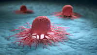 Un groupe de cellules cancéreuses isolées qui pourraient être traitées par thérapie cellulaire grâce aux lymphocytes NK. © peterschreiber.media, Adobe stock