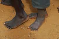 L’étude s’est intéressée aux pieds de 81 adultes au Kenya, dont certains ne portaient jamais de chaussures. © africa, Fotolia