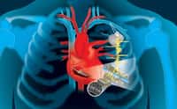 Le principe du système de recharge piézoélectrique d’un pacemaker. © Patricio R. Sarzosa, Thayer School of Engineering