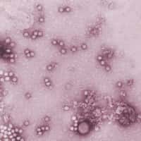 AAV2 est un petit virus de la famille des virus adéno-associés (AAV). © AJ Cann, www.microbiologybytes.com, Flickr, CC by nc 2.0