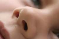 Découvrir la polypose nasale, une maladie méconnue qui touche pourtant près d’un million de Français