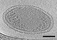 Des scientifiques ont observé la structure interne de bactéries ultra petites. Le compartiment interne est dense et protégé par une paroi cellulaire. La barre représente 100 nanomètres. © Berkeley Lab