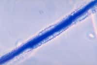 L'aflatoxine provient des premières lettres du nom du genre et de l'espèce de champignon qui la produit : Aspergillus flavus, que l'on voit à l'image. La molécule est suspectée de causer les dommages hépatiques de la maladie qui frappe le Vietnam. Mais elle&nbsp;n'explique probablement pas tous les symptômes.&nbsp;© Libero Ajello, CDC, DP