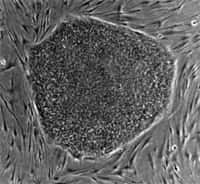 Cellules de peau après leur reprogrammation en cellules souches. © National Institutes of Health
