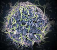 Les particules virales du virus Ebola (en vert) infectant une cellule, vue par microscopie électronique. © Niaid