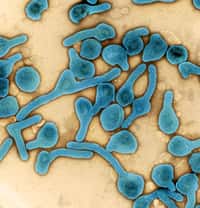 Le virus de Marburg, l’un des quatre virus de niveau 4 importé au Japon le mois dernier. © NIAIDle Japon importe 4 virus pour les JO 