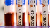 Coronavirus : on peut être infecté plusieurs fois de suite. © Nordicstocks, Adobe Stock