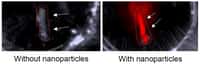 À gauche, une image de plaque d’athérome sans nanoparticules. À droite, les nanoparticules émettent des ultrasons qui sont convertis en image optique 3D. © Adv. Funct. Mater