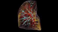 Les poumons d’un patient infecté par la Covid vus en tomographie à contraste de phase hiérarchique (HiP-CT). © UCL, ESRF