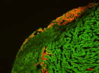 Des cellules souches embryonnaires humaines indifférenciées ont été transplantées dans des cultures organotypiques de cœur de rat. Deux mois plus tard, on retrouve ces cellules humaines, colorées ici en rouge par marquage d'antigène nucléaire humain, dans le parenchyme cardiaque de rat (coloré en vert). © Inserm, Walter Habeler