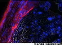 Détection du virus Chikungunya (en rouge) dans une articulation de souris, par une observation en microscopie à fluorescence. © T. Couderc & M. Lecuit/Institut Pasteur/Inserm