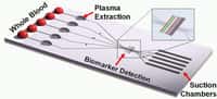 Un prototype de laboratoire sur puce, destiné à l'analyse du plasma sanguin, élaboré grâce à la microfluidique et ne nécessitant aucun circuit électronique. Une minime quantité de sang (Whole Blood) est insérée (à gauche). C'est une pression d'air plus faible (Suction Chambers) qui attire le liquide vers la droite. Plus lourds, les globules rouges et les globules blancs s'arrêtent dans la première chambre (Plasma Extraction). Le plasma seul s’écoule jusqu’au détecteur de biomarqueurs (Biomarker Detection) où est réalisée l'analyse. Ce genre de dispositif nécessite le contrôle fin du mouvement de fluides à toute petite échelle, ce que l'on ne sait pas encore bien faire. © Ivan Dimov, UC Berkeley