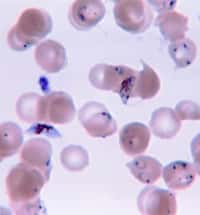 Dans un globule rouge infecté par le parasite de la malaria, la paroi vibre moins facilement. L'écoute à l'aide d'un microphone nanométrique pourrait donc faire la différence entre une cellule saine et une cellule malade. © US CDC, domaine public