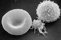Les trois familles de cellules sanguines, vues au microscope électronique à balayage. De gauche à droite, un globule rouge (qui a perdu son noyau, donc ses gènes), une plaquette et un globule blanc. Les gènes de ces deux derniers pourraient-ils différer de ceux du reste de l'organisme ? © Licence Commons