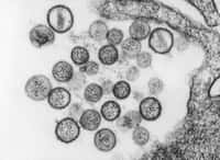 L'hantavirus Sin Nombre, ici vu au microscope électronique à transmission, appartient à la famille des Bunyaviridés et mesure quelque 100 nm de diamètre, potentiellement mortels ! © Bryan et al., CDC, DP