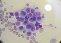 Cette lignée cellulaire a 11.000 ans... C'est celle d'une tumeur vénérienne du chien, ou TVTC. Les cellules tumorales se divisent activement, et durant longtemps, comme le démontre la lignée HeLa, des cellules issues d'une métastase d'un cancer du col de l'utérus, prélevée sur le corps d'Henrietta Lacks en 1951 et toujours utilisée en laboratoire. La nouveauté est que les cellules des TVTC peuvent passer d'un animal à l'autre et y prospérer, au moins dans les parties génitales externes. © Joel Mills, GNU 1.2