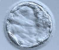 Un blastocyste, quelques jours après la fécondation. © Institute of Human Genetics/Newcastle University
