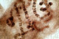 La trisomie 21 se caractérise par la présence anormale d'un troisième chromosome 21, alors qu'une personne est censée avoir chaque chromosome en seulement deux exemplaires. Mais grâce au gène Xist, des chercheurs sont parvenus in vitro à éteindre l'expression des gènes dans cet ADN en trop. © Lesliemiperry, Flickr, cc by nd 2.0