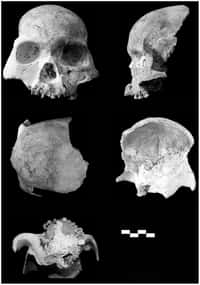 Fragments de crâne trouvés dans une grotte près du village de Longlin en Chine. Ils datent d'une époque marquant la transition entre le Pléistocène et l'Holocène. La barre d'échelle représente 1 cm. © Darren Curnoe et al. 2012, Plos One